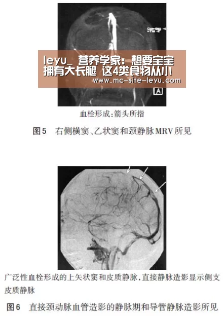 leyu_
营养学家:想要宝宝拥有大长腿 这4类食物从小要多吃